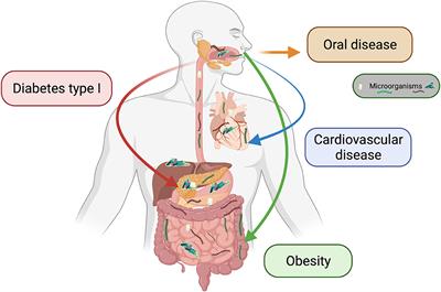 Exploring the Interplay Between Oral Diseases, Microbiome, and Chronic Diseases Driven by Metabolic Dysfunction in Childhood